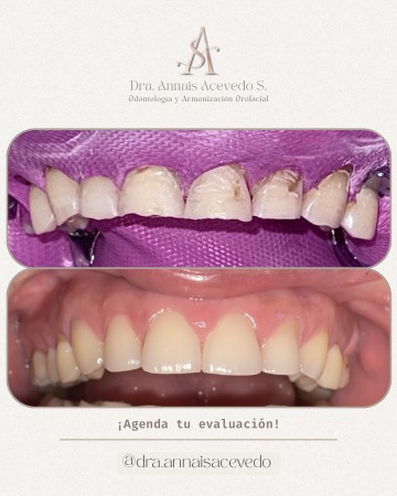 Imagen principal del servicio