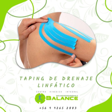 Imagen 21 de servicio
