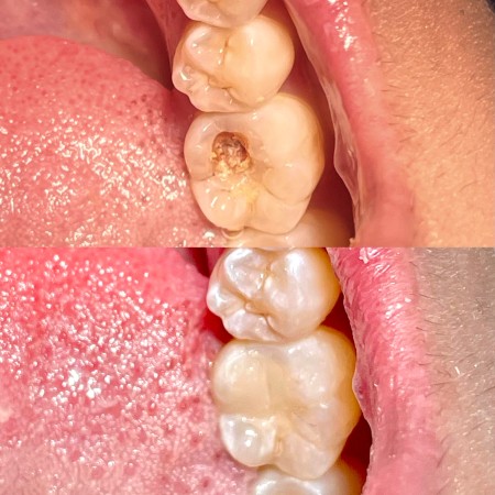 Imagen 4 de servicio