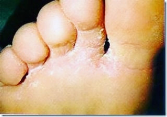 Imagen 5 de servicio