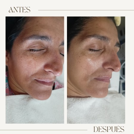 Imagen 6 de servicio