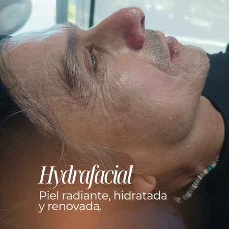 Imagen 5 de servicio