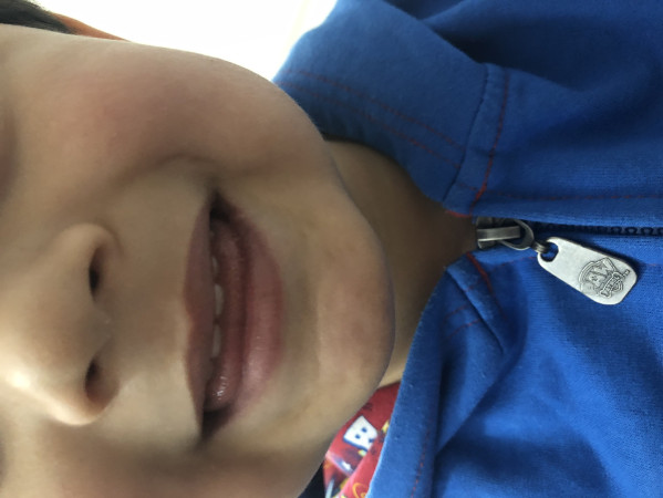 Imagen 5 de servicio