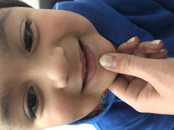 Imagen 8 de servicio