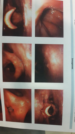 Imagen 14 de servicio