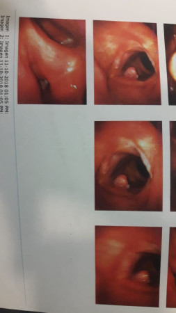 Imagen 15 de servicio