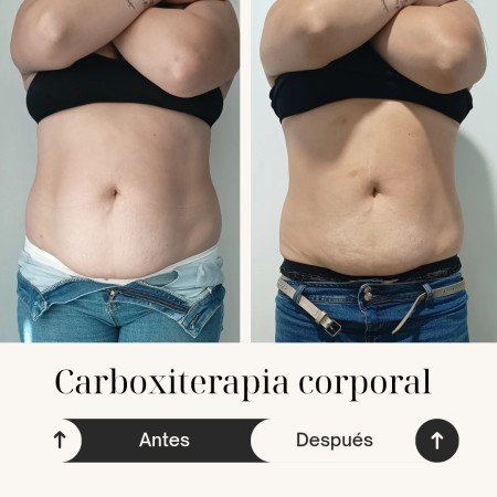 Imagen principal del servicio
