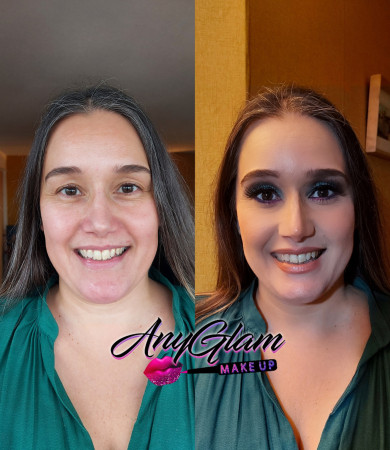 Imagen 5 de servicio