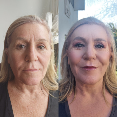 Imagen 14 de servicio