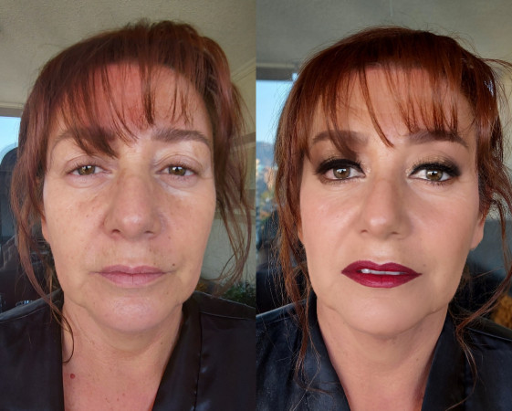 Imagen 15 de servicio