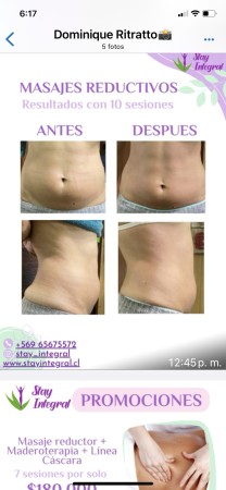 Imagen 7 de servicio