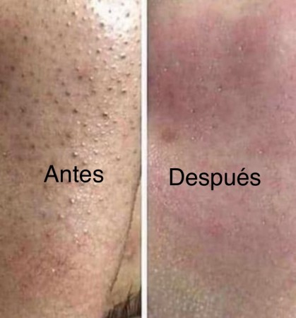 Imagen 8 de servicio