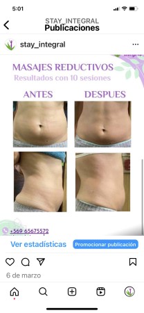 Imagen 10 de servicio