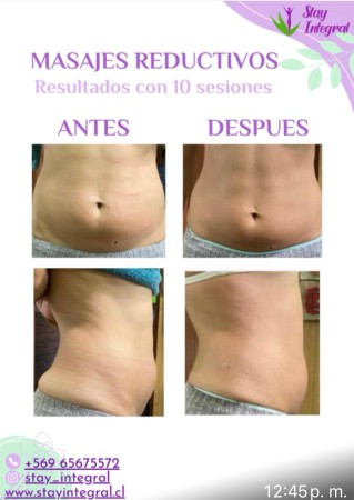 Imagen 31 de servicio