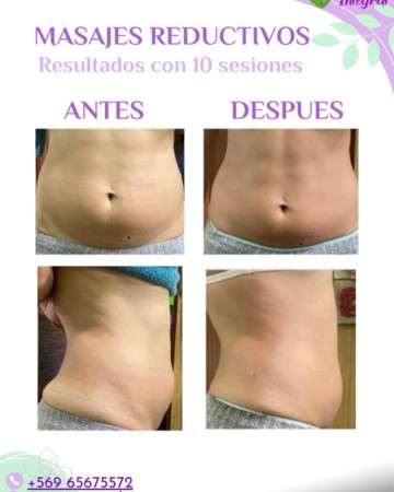 Imagen 34 de servicio