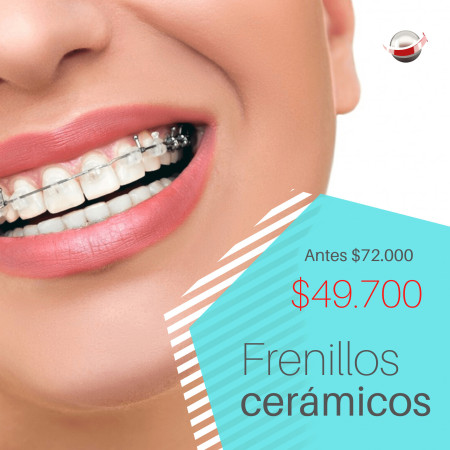 Imagen 11 de servicio