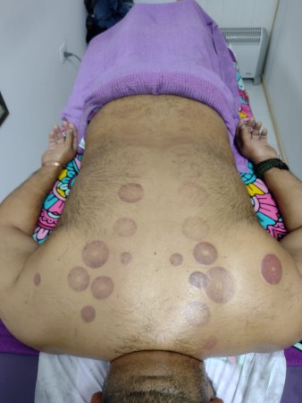 Imagen 2