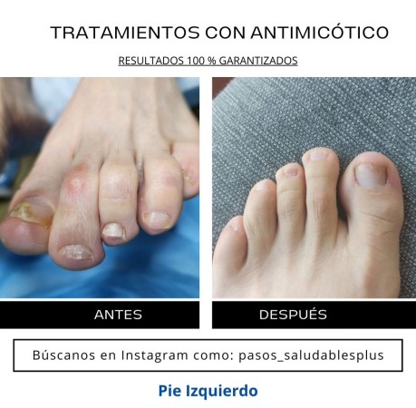 Imagen 3 de servicio