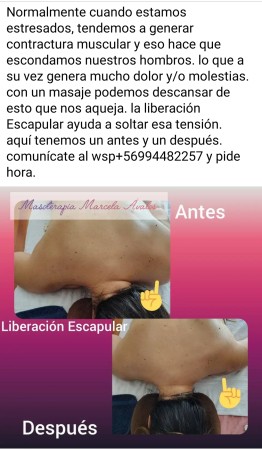 Imagen 3 de servicio