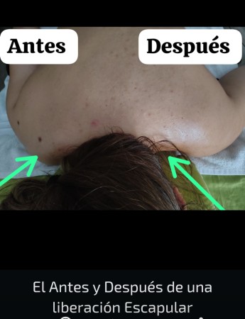 Imagen 4 de servicio