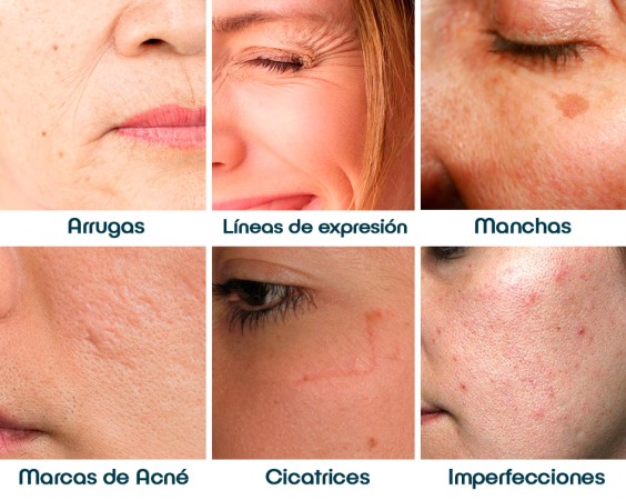 Imagen principal del servicio
