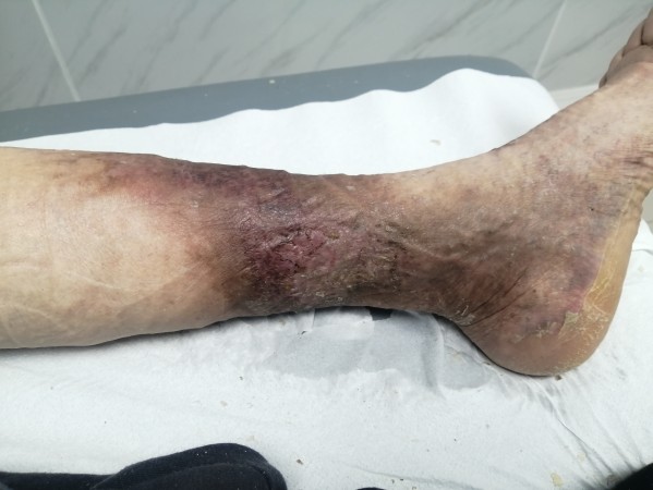 Imagen 6 de servicio