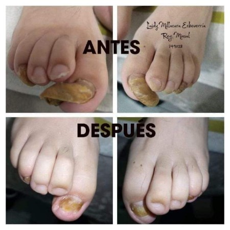 Imagen 0
