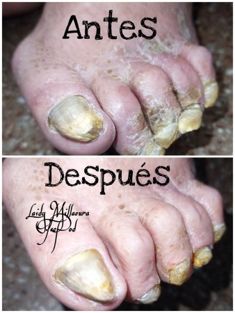 Imagen 5 de servicio