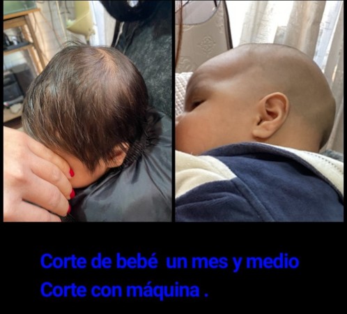 Imagen 5 de servicio