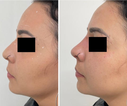 Imagen 3 de servicio