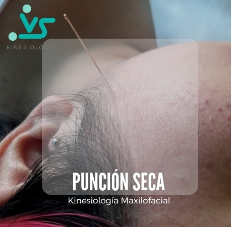 Imagen 5 de servicio