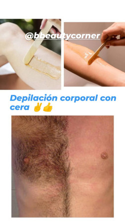 Imagen 6 de servicio