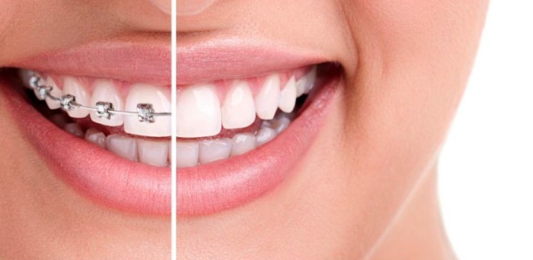 Imagen principal del servicio