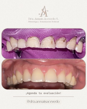 Imagen 3 de servicio