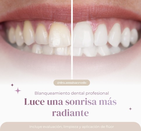 Imagen principal del servicio