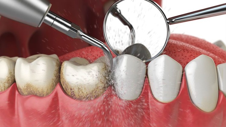 Imagen principal del servicio