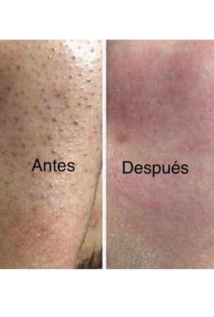 Imagen principal del servicio
