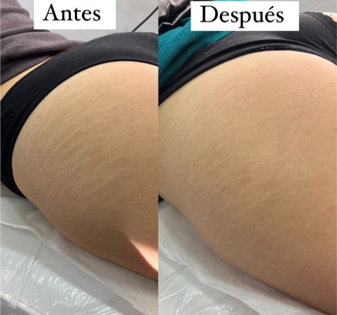 Imagen principal del servicio