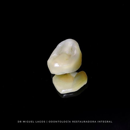 Imagen 3 de servicio