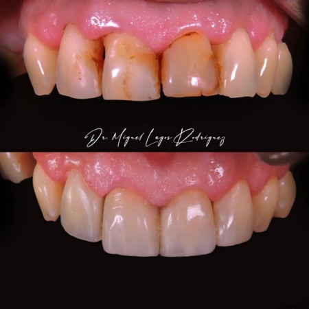 Imagen 4 de servicio