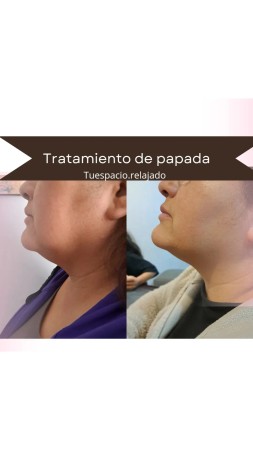 Imagen principal del servicio