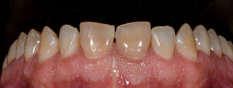 Imagen 3 de servicio