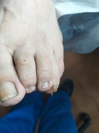 Imagen 6 de servicio