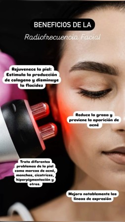 Imagen 6 de servicio