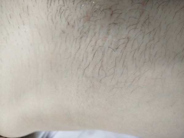 Imagen 11 de servicio