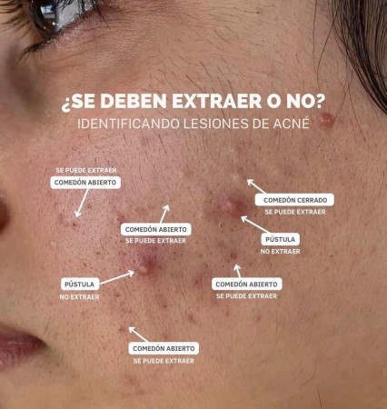 Imagen 4 de servicio